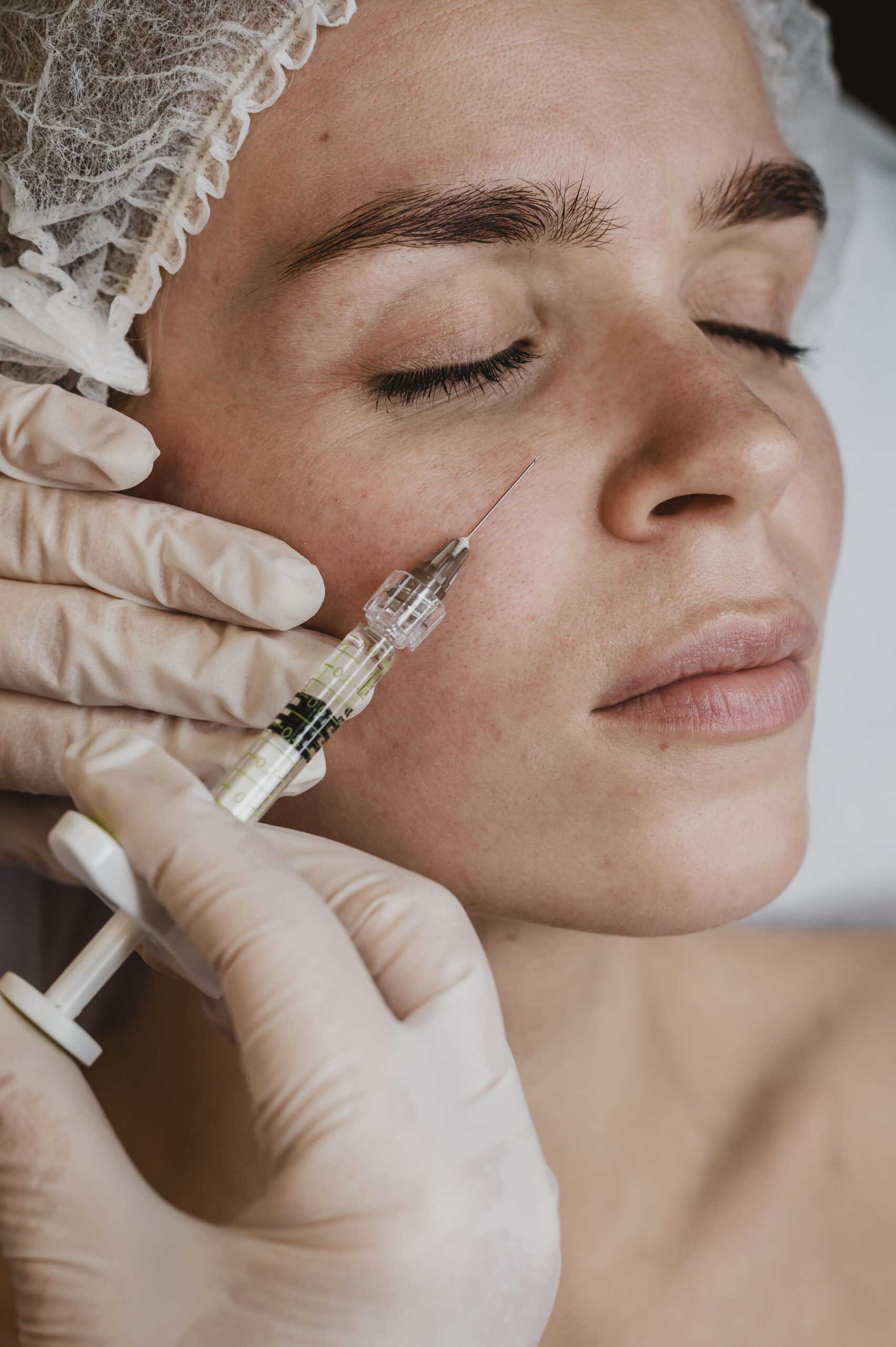 dermal fillers in florida